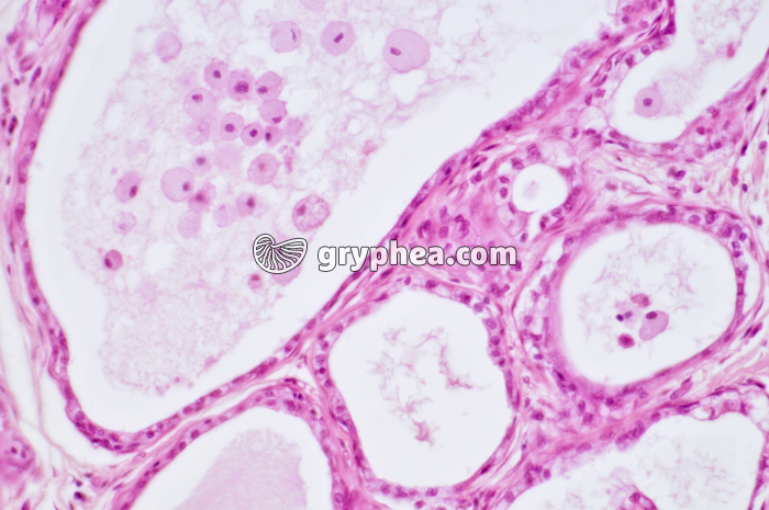 Glande mammaire active CT x100 - gryphea.com